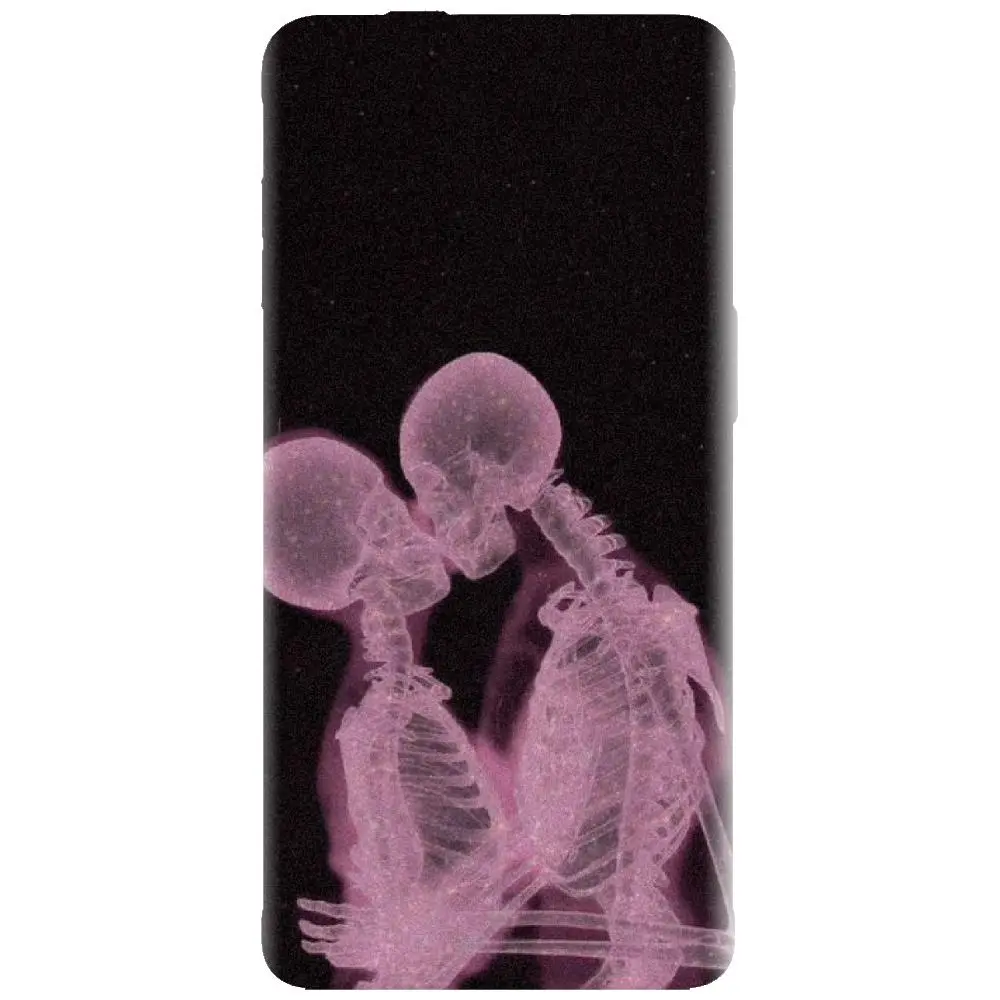 Husa din silicon - model X Ray